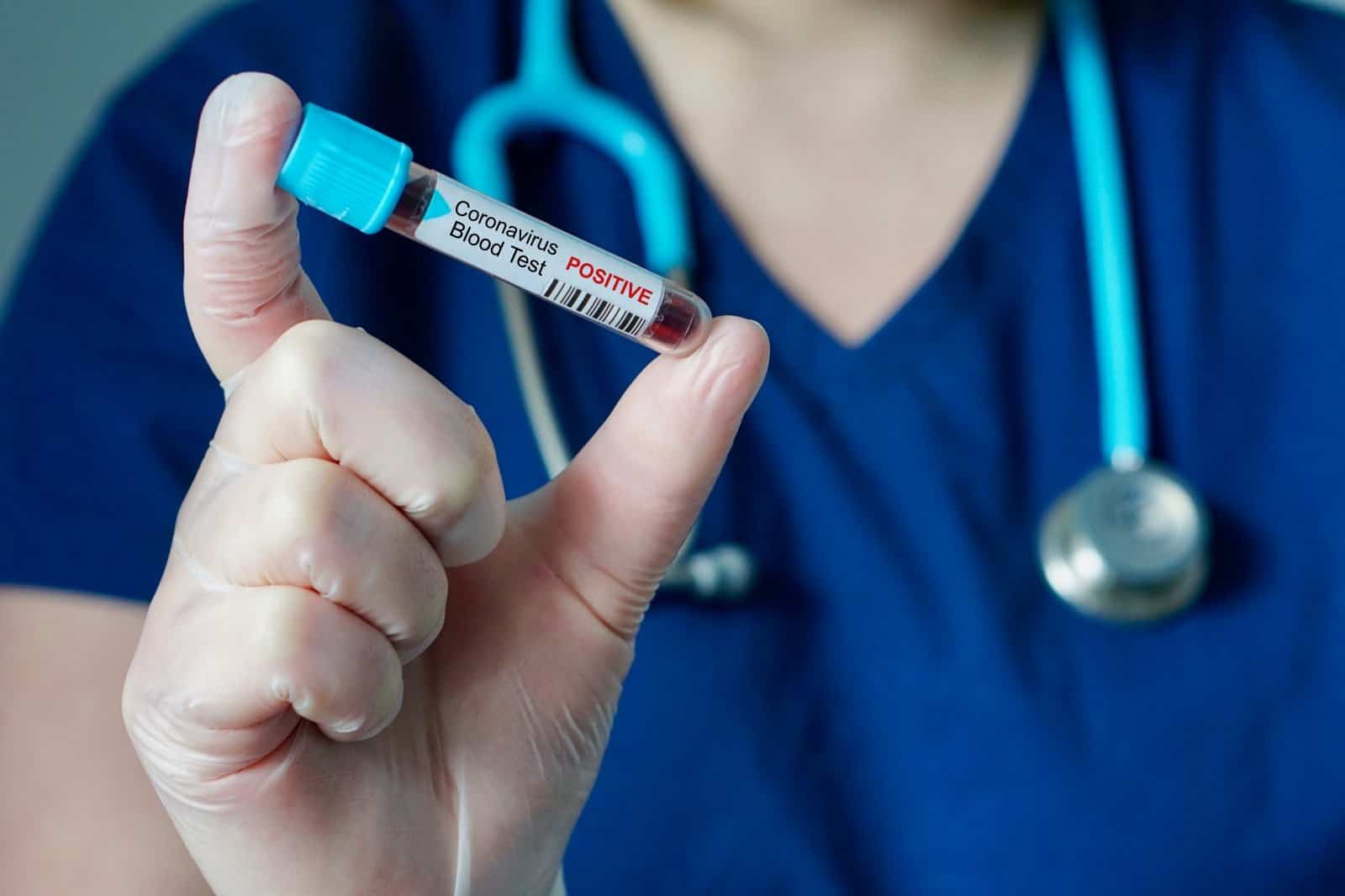 Covid-19: ANS determina inclusão de testes sorológicos no Rol de Procedimentos obrigatórios